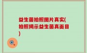 益生菌拍照图片真实(拍照揭示益生菌真面目)