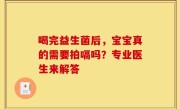 喝完益生菌后，宝宝真的需要拍嗝吗？专业医生来解答