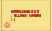 蛇缠腰益生菌(益生菌：腰上缠蛇？如何摆脱？)
