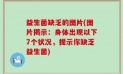 益生菌缺乏的图片(图片揭示：身体出现以下7个状况，提示你缺乏益生菌)
