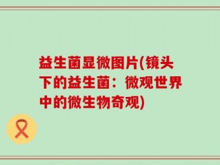 益生菌显微图片(镜头下的益生菌：微观世界中的微生物奇观)