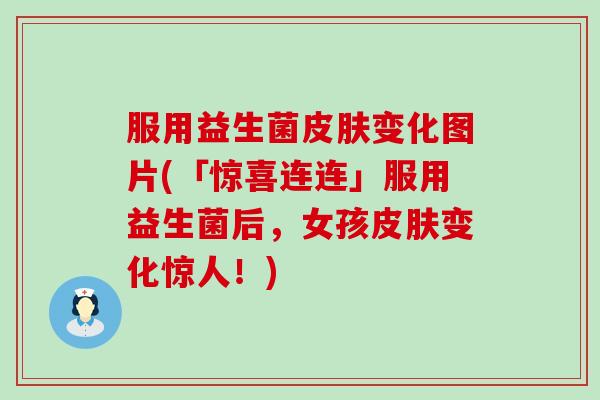 服用益生菌变化图片(「惊喜连连」服用益生菌后，女孩变化惊人！)