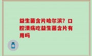 益生菌含片哈尔滨？口腔溃疡吃益生菌含片有用吗