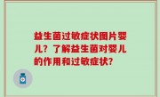 益生菌过敏症状图片婴儿？了解益生菌对婴儿的作用和过敏症状？