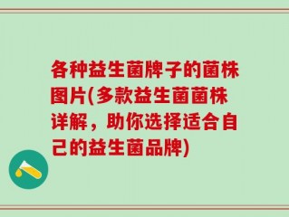 各种益生菌牌子的菌株图片(多款益生菌菌株详解，助你选择适合自己的益生菌品牌)