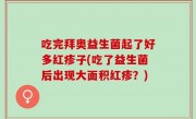 吃完拜奥益生菌起了好多红疹子(吃了益生菌后出现大面积红疹？)
