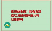 密瑾益生菌？我有宫颈糜烂,用密瑾抑菌片可以用好吗
