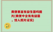 粪便里面有益生菌吗图片(粪便中含有有益菌，惊人照片证实)