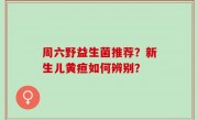 周六野益生菌推荐？新生儿黄疸如何辨别？