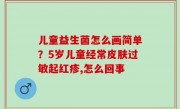 儿童益生菌怎么画简单？5岁儿童经常皮肤过敏起红疹,怎么回事