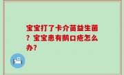 宝宝打了卡介苗益生菌？宝宝患有鹅口疮怎么办？
