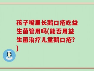 孩子嘴里长鹅口疮吃益生菌管用吗(能否用益生菌治疗儿童鹅口疮？)