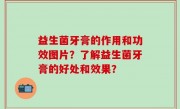 益生菌牙膏的作用和功效图片？了解益生菌牙膏的好处和效果？