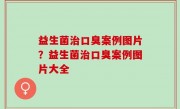 益生菌治口臭案例图片？益生菌治口臭案例图片大全