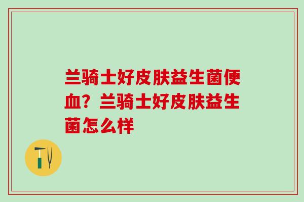 兰骑士好益生菌便？兰骑士好益生菌怎么样