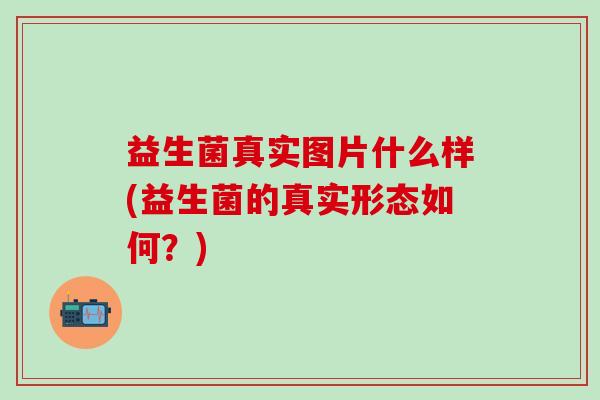 益生菌真实图片什么样(益生菌的真实形态如何?) 益生菌真实图片什么样(益生菌的真实形态如何?)